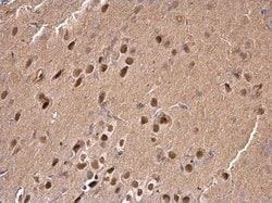 Invitrogen SAM68 Polyclonal Antibody 100 &mu;L; Unconjugated:Antibodies,
