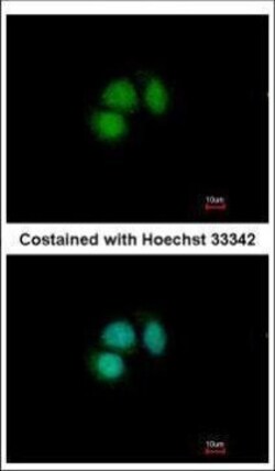 Invitrogen CUG-BP2 Polyclonal Antibody 100 &mu;L; Unconjugated:Antibodies,
