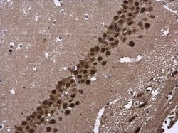 Invitrogen CUG-BP2 Polyclonal Antibody 100 &mu;L; Unconjugated:Antibodies,
