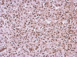 Invitrogen CUG-BP2 Polyclonal Antibody 100 &mu;L; Unconjugated:Antibodies,