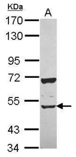 Invitrogen CUG-BP2 Polyclonal Antibody 100 &mu;L; Unconjugated:Antibodies,