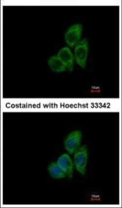 Invitrogen TCP-1 theta Polyclonal Antibody 100 &mu;L; Unconjugated:Antibodies,