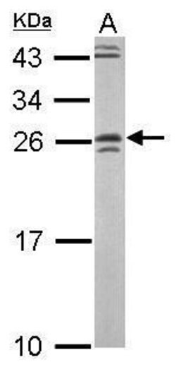 Invitrogen GRAP Polyclonal Antibody 100 &mu;L | Buy Online | Invitrogen&trade; | Fisher Scientific