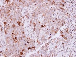Invitrogen NCKAP1 Polyclonal Antibody 100 &mu;L; Unconjugated:Antibodies,