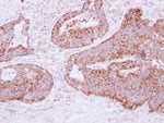 Thumbnail_MTHFD2 Polyclonal Antibody:Antibodies