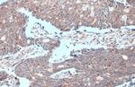 Thumbnail_MTHFD2 Polyclonal Antibody:Antibodies