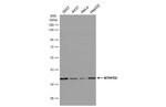 Thumbnail_MTHFD2 Polyclonal Antibody:Antibodies