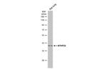 Thumbnail_MTHFD2 Polyclonal Antibody:Antibodies