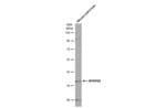 Thumbnail_MTHFD2 Polyclonal Antibody:Antibodies
