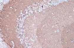 CYP46A1 Polyclonal Antibody:Antibodies, Polyclonal