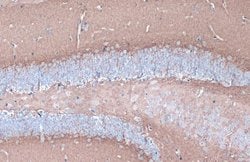 CYP46A1 Polyclonal Antibody:Antibodies, Polyclonal