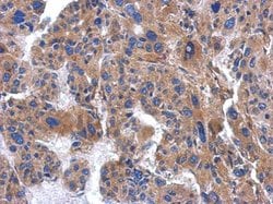 Invitrogen AP3M2 Polyclonal Antibody 100 &mu;L; Unconjugated:Antibodies,