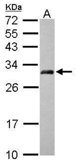 Invitrogen AP3M2 Polyclonal Antibody 100 &mu;L; Unconjugated:Antibodies,