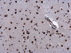 Invitrogen HP1 beta Polyclonal Antibody 100 &mu;L; Unconjugated:Antibodies,