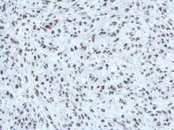 Invitrogen HP1 beta Polyclonal Antibody 100 &mu;L; Unconjugated:Antibodies,