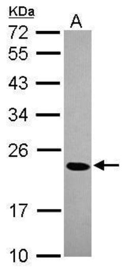 Invitrogen HP1 beta Polyclonal Antibody 100 &mu;L; Unconjugated:Antibodies,