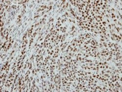 Invitrogen RbAp48 Polyclonal Antibody 100 &mu;L; Unconjugated:Antibodies,