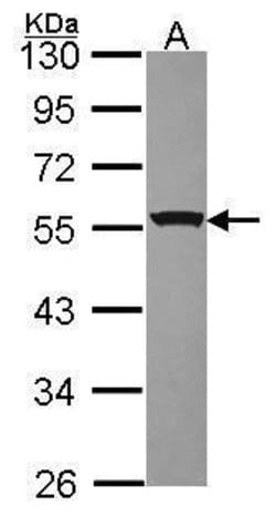 Invitrogen RbAp48 Polyclonal Antibody 100 &mu;L; Unconjugated:Antibodies,