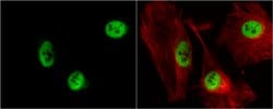 Invitrogen RbAp48 Polyclonal Antibody 100 &mu;L; Unconjugated:Antibodies,