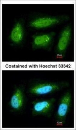 Invitrogen DUSP10 Polyclonal Antibody 100 &mu;L; Unconjugated:Antibodies,