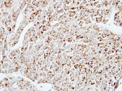 Invitrogen DUSP10 Polyclonal Antibody 100 &mu;L; Unconjugated:Antibodies,