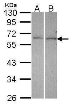 Invitrogen DUSP10 Polyclonal Antibody 100 &mu;L; Unconjugated:Antibodies,