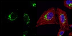 Invitrogen HSPE1 Polyclonal Antibody 100 &mu;L; Unconjugated:Antibodies,
