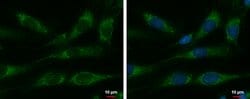 Invitrogen HSPE1 Polyclonal Antibody 100 &mu;L; Unconjugated:Antibodies,