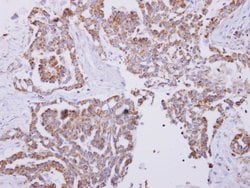 Invitrogen HSPE1 Polyclonal Antibody 100 &mu;L; Unconjugated:Antibodies,