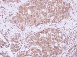 Invitrogen ATE1 Polyclonal Antibody 100 &mu;L; Unconjugated:Antibodies,