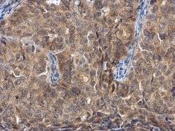 FGFR1OP Polyclonal Antibody:Antibodies, Polyclonal