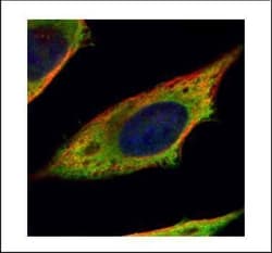 Invitrogen Calpain 11 Polyclonal Antibody 100 &mu;L | Buy Online | Invitrogen&trade; | Fisher Scientific