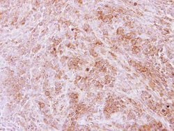 Invitrogen Calpain 11 Polyclonal Antibody 100 &mu;L | Buy Online | Invitrogen&trade; | Fisher Scientific