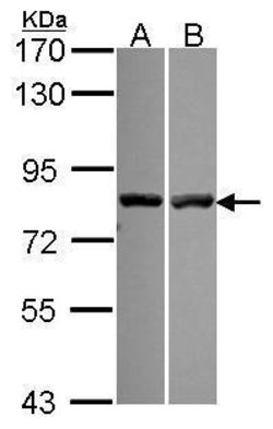 Invitrogen Calpain 11 Polyclonal Antibody 100 &mu;L | Buy Online | Invitrogen&trade; | Fisher Scientific