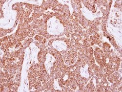 Invitrogen NUDT3 Polyclonal Antibody 100 &mu;L; Unconjugated:Antibodies,