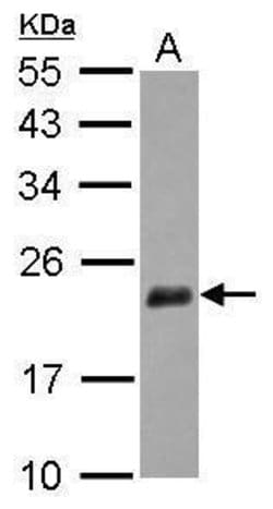 Invitrogen NUDT3 Polyclonal Antibody 100 &mu;L; Unconjugated:Antibodies,