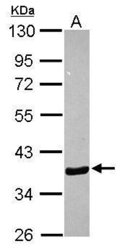 Invitrogen Annexin A10 Polyclonal Antibody 100 &mu;L; Unconjugated:Antibodies,