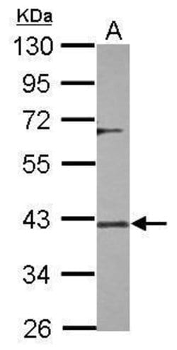 Invitrogen DUSP12 Polyclonal Antibody 100 &mu;L; Unconjugated:Antibodies,