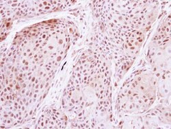 Invitrogen DDX19B Polyclonal Antibody 100 &mu;L; Unconjugated:Antibodies,