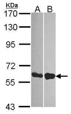Invitrogen DDX19B Polyclonal Antibody 100 &mu;L; Unconjugated:Antibodies,