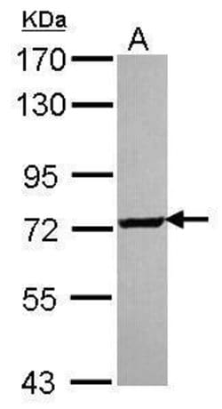 Invitrogen SCMH1 Polyclonal Antibody 100 &mu;L; Unconjugated:Antibodies,