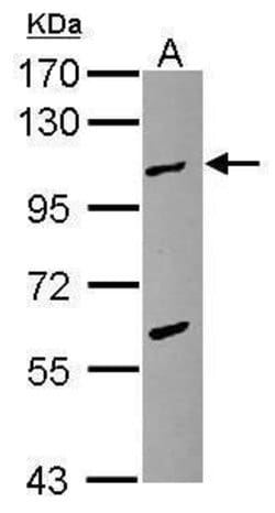 TPX2 Polyclonal Antibody:Antibodies, Polyclonal