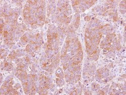 Invitrogen NT5C2 Polyclonal Antibody 100 &mu;L; Unconjugated:Antibodies,