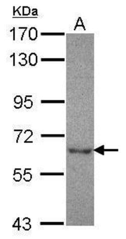Invitrogen NT5C2 Polyclonal Antibody 100 &mu;L; Unconjugated:Antibodies,