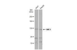 Invitrogen SMC5 Polyclonal Antibody 100 &mu;L; Unconjugated:Antibodies,