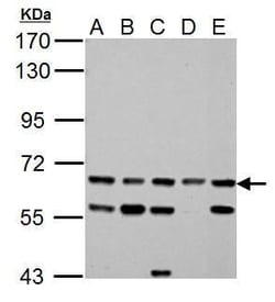 Invitrogen ACSL6 Polyclonal Antibody 100 μL; Unconjugated:Antibodies,