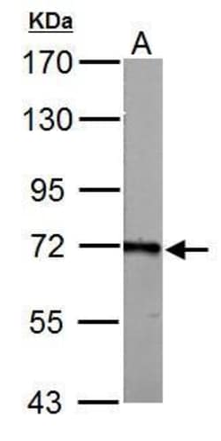 Invitrogen ACSL6 Polyclonal Antibody 100 μL; Unconjugated:Antibodies,