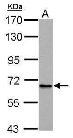 Invitrogen ABCB10 Polyclonal Antibody 100 &mu;L; Unconjugated:Antibodies,