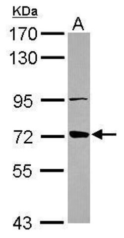 Invitrogen ABCB10 Polyclonal Antibody 100 &mu;L; Unconjugated:Antibodies,