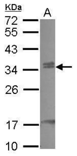 Invitrogen CBX7 Polyclonal Antibody 100 &mu;L; Unconjugated:Antibodies,